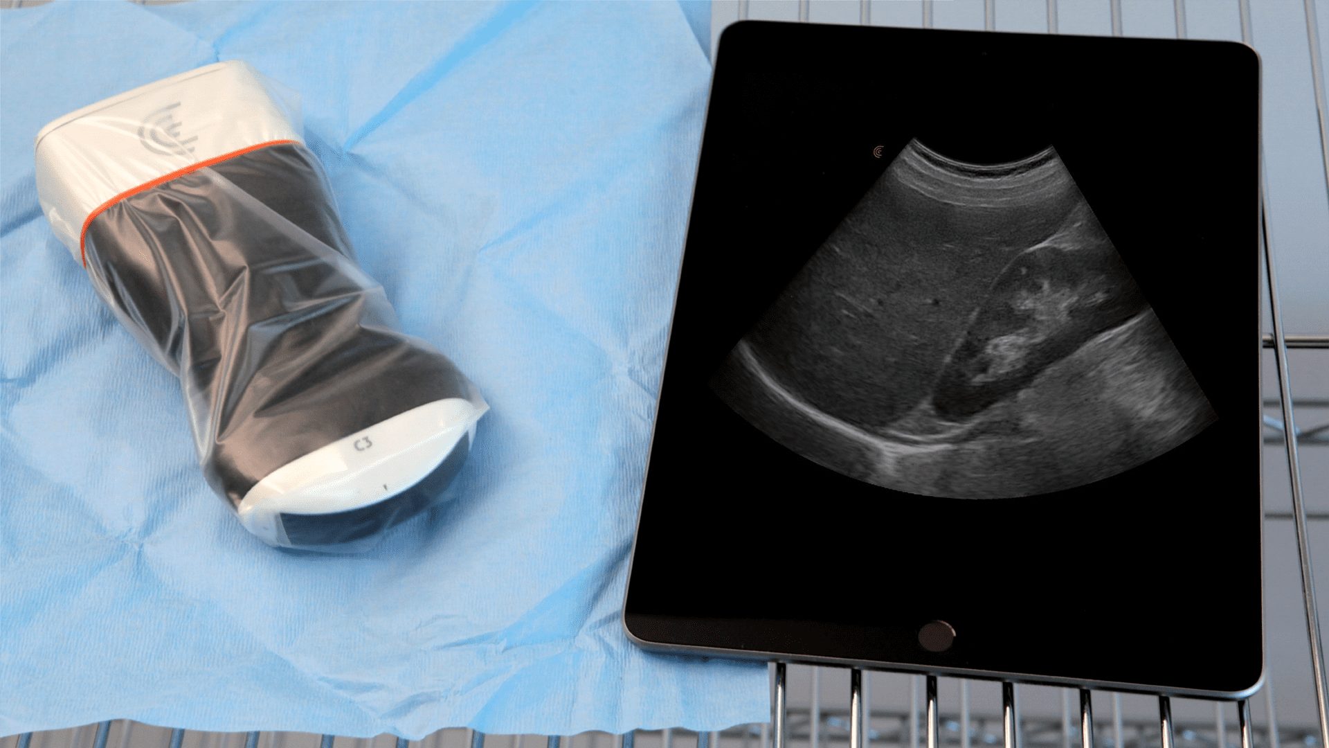 Why Handheld Ultrasound is a Safer Option for Infection Control