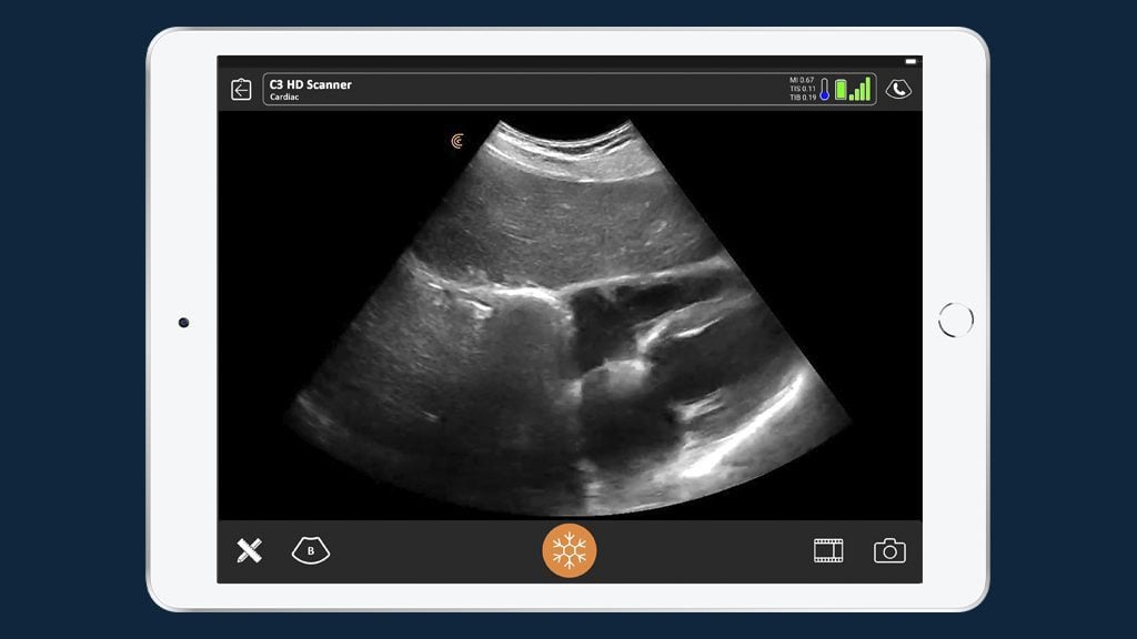 Echocardiography Society’s Perspective on POCUS for COVID-19